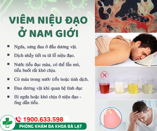 Hình ảnh minh họa